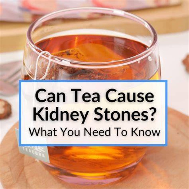 Can unsweet tea cause kidney stones?