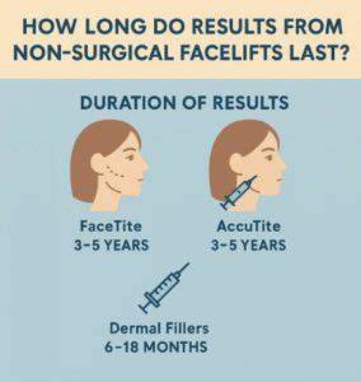 How long do facelifts last?