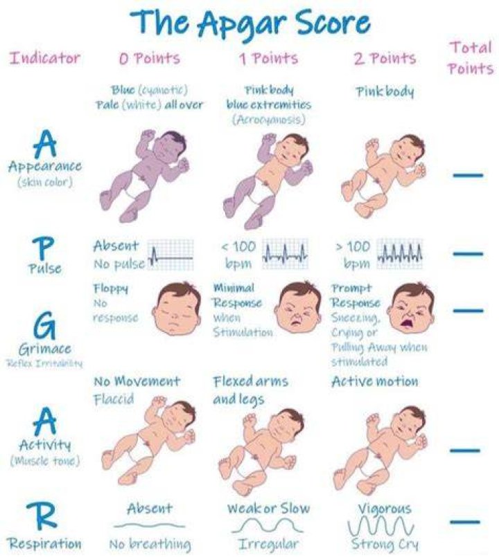 When are apgar scores taken?