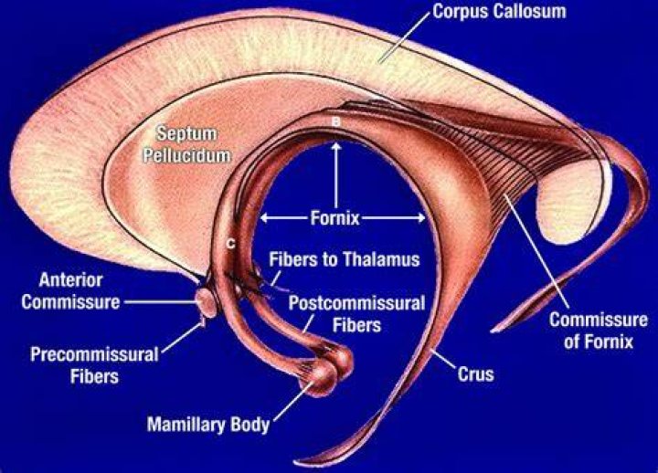 Where is forniceal rupture?