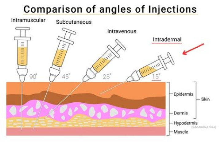 Which vaccines are given intradermally?