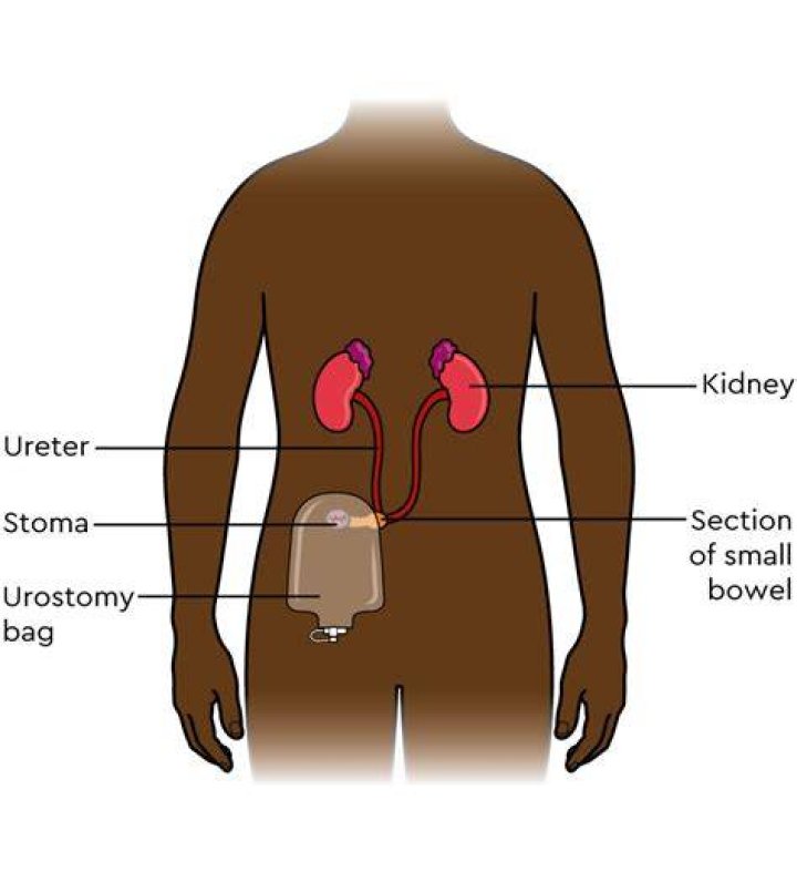 Why stomach empties slowly?
